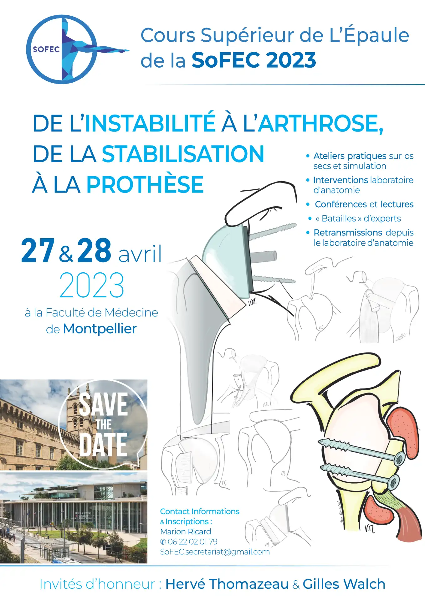 Cours supérieur de l’épaule 2023